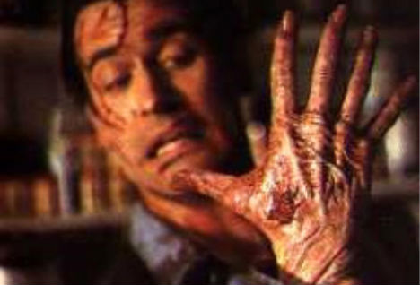 weird-diseases-alien-hand-syndrome