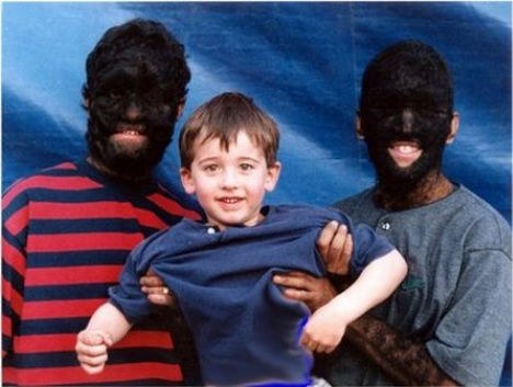 weird-diseases-human-werewolf