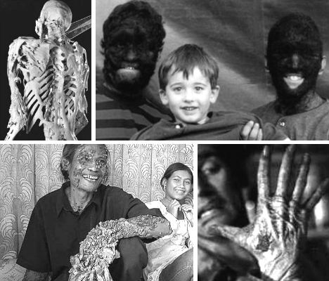 weird-diseases-main