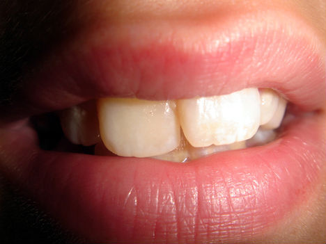 animal-biomimicry-human-tooth-structure
