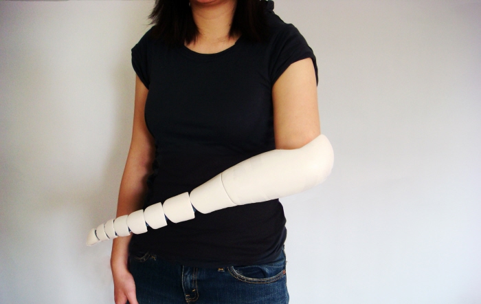 prosthetic arm